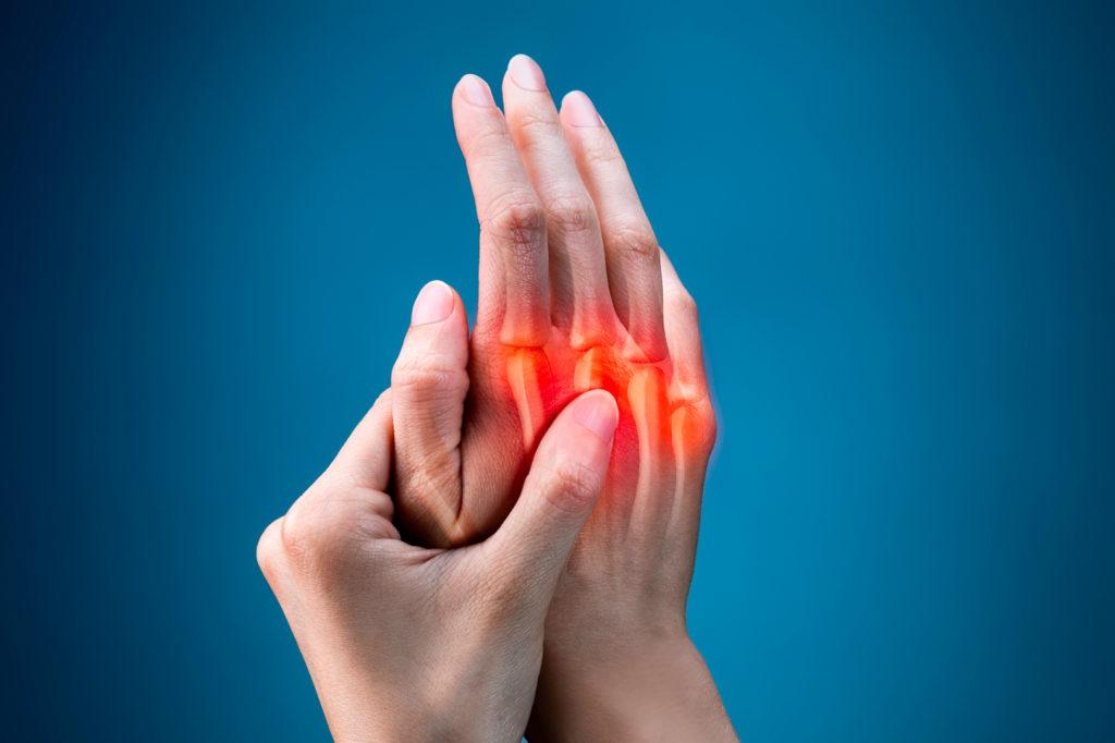 Find Out if Knuckle Cracking Can Actually Lead to Arthritis